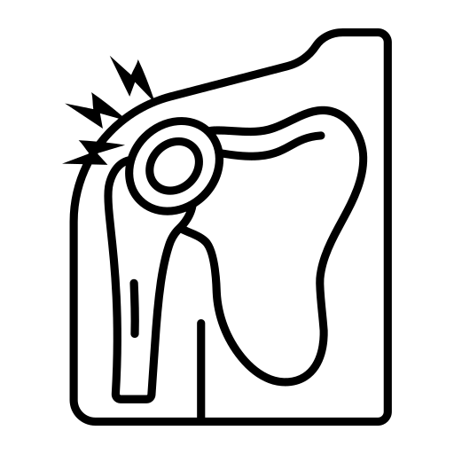 Arthroscopic Shoulder Surgery