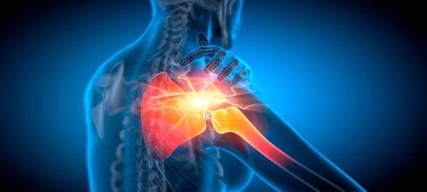 Dr. Sonawane performing shoulder surgery at Dr. Sonawane's Hospital, Nerul Navi Mumbai